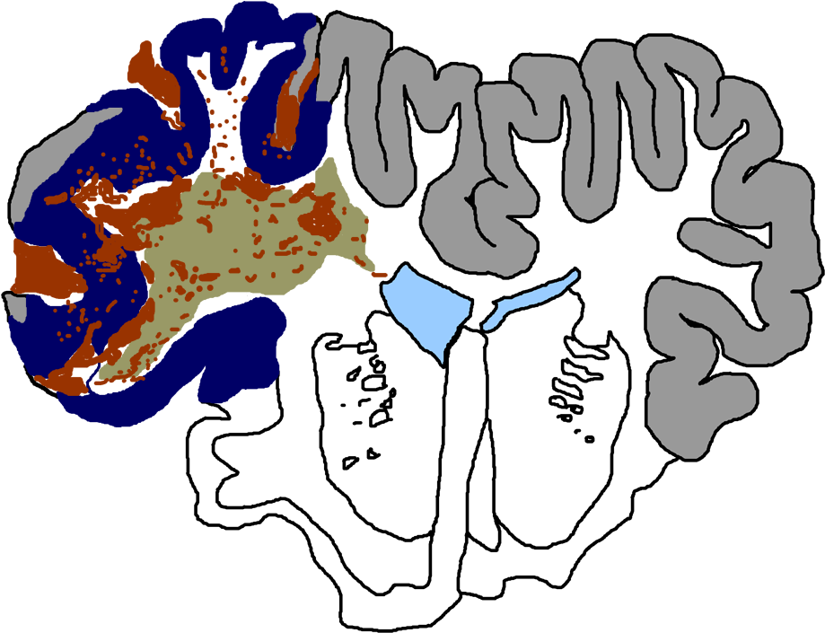 Traumatic Injury Cosbid Co Operative Studies On - Illustration (960x741)