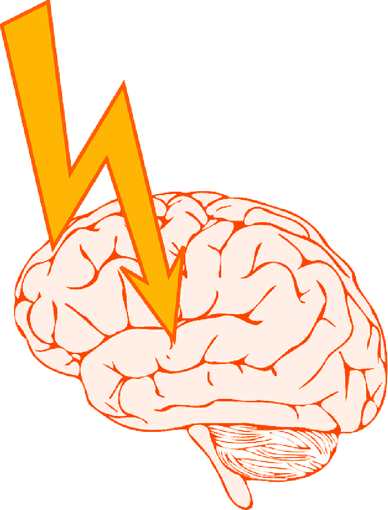 Knowledge Clipart Seizure - Free Childs Seziure Brain Clip Art (800x1051)