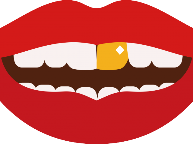 Lips Clipart Juicy Lip - Girl With Gold Teeth Clipart (640x480)