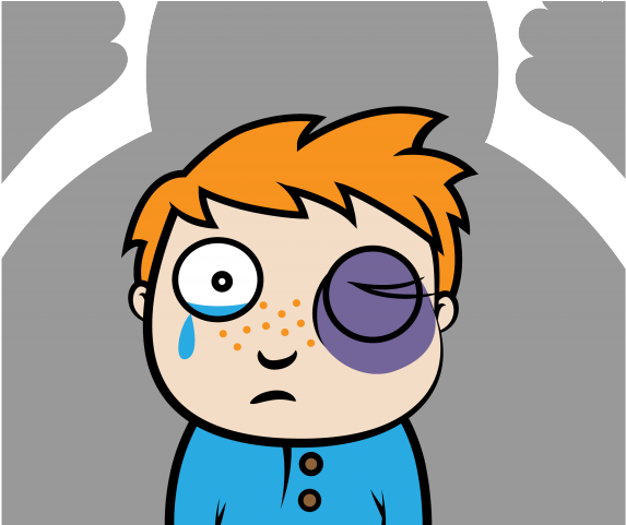 Fighting Clipart Hurt Eye - Cartoon Physical Bullying Bullied (640x480)