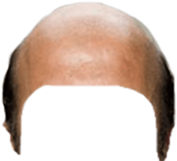 Head Clipart 0 - Bald Head No Background (400x400)