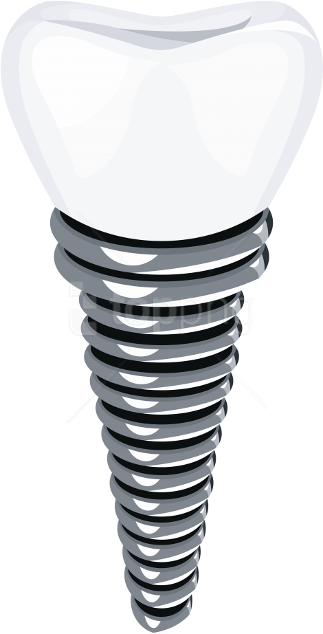 Free Png Download Dental Implant Clipart Png Photo - Table (480x929)