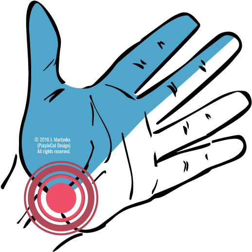 Tunnel Clipart Transparent - Carpal Tunnel Syndrome Transparent Background (560x560)