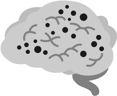 Alzheimers Disease Icon Transparent , Png Download - Alzheimer Png (388x319)