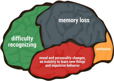 Concerned Family Members May Be Unable To Keep A Loved - Concerned Family Members May Be Unable To Keep A Loved (443x276)