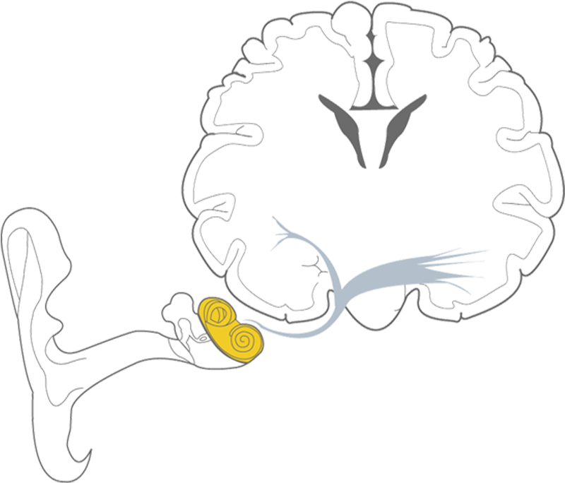 Types Of Hearing Loss - Sketch (800x800)