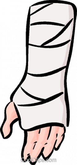 Broken Arm Clipart - Broken Arm Clip Art (250x533)