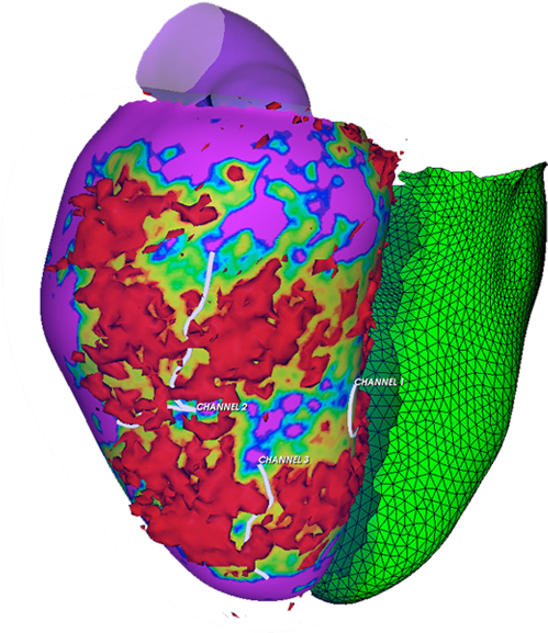 Electrophysiologist To Identify The Arrhythmia Substrate - Illustration (600x600)