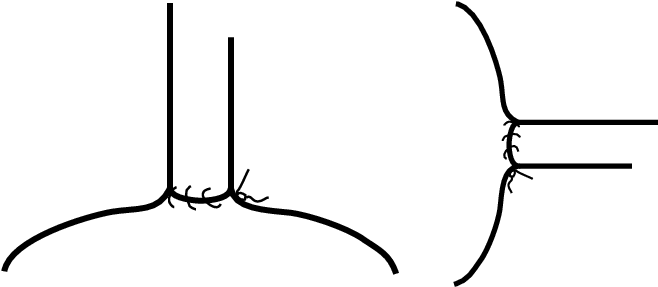 Coronal And Transverse Views Illustrating The Technique - Coronal And Transverse Views Illustrating The Technique (659x293)
