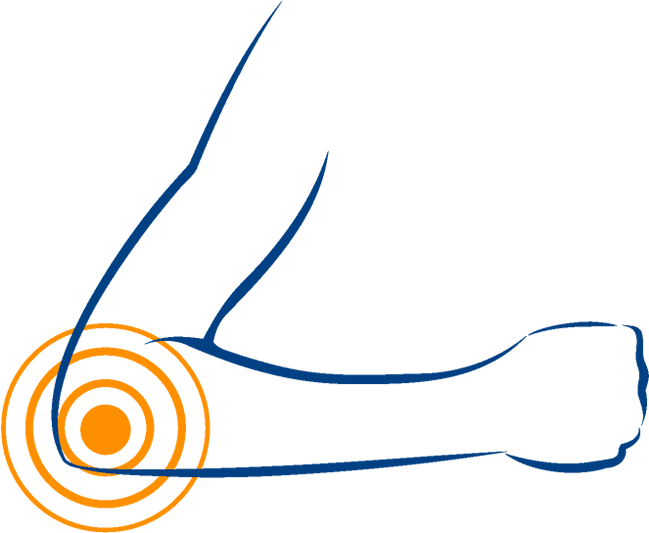 Elbow - Elbow (654x745)