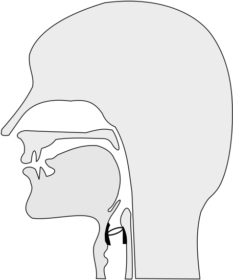 Sound Is Generated By The Vocal Folds When Air Pressure - Illustration (540x571)