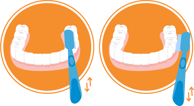 Para Las Superficies Vestibulares Las Arcadas Se Encuentran - Tecnica Horizontal De Cepillado (653x358)