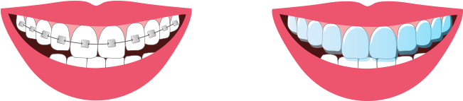 Los Frenos Han Cambiado Con Los Años - Los Frenos Han Cambiado Con Los Años (650x200)