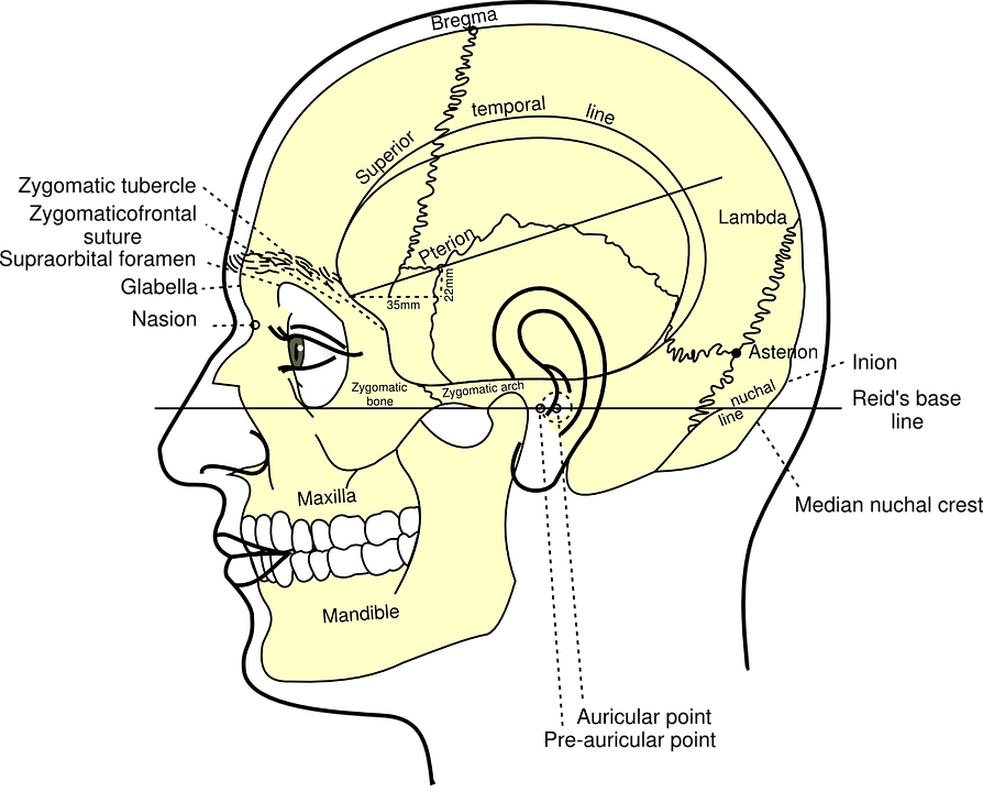 Skull Diagram Head - Diagram Of Human Head (894x720)