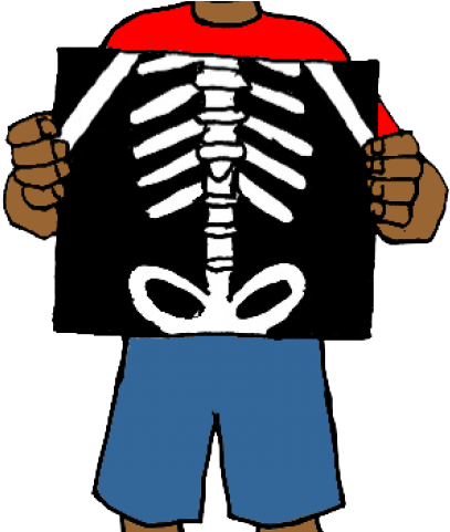 Original - X Ray Clipart Png (640x480)