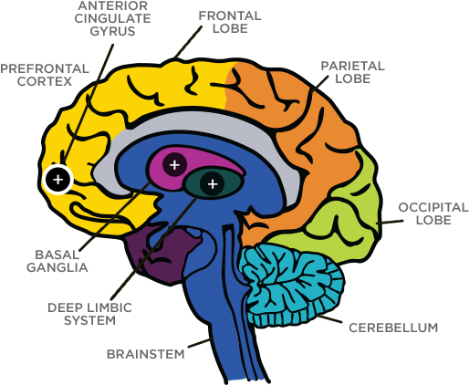 7 Types Of Add, Depression, Anxiety &amp - 7 Types Of Add, Depression, Anxiety &amp (527x437)
