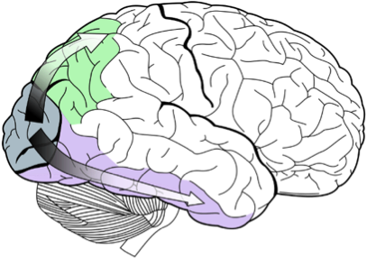 The "what" Pathway Uses Detailed Visual Information - Brain (437x312)