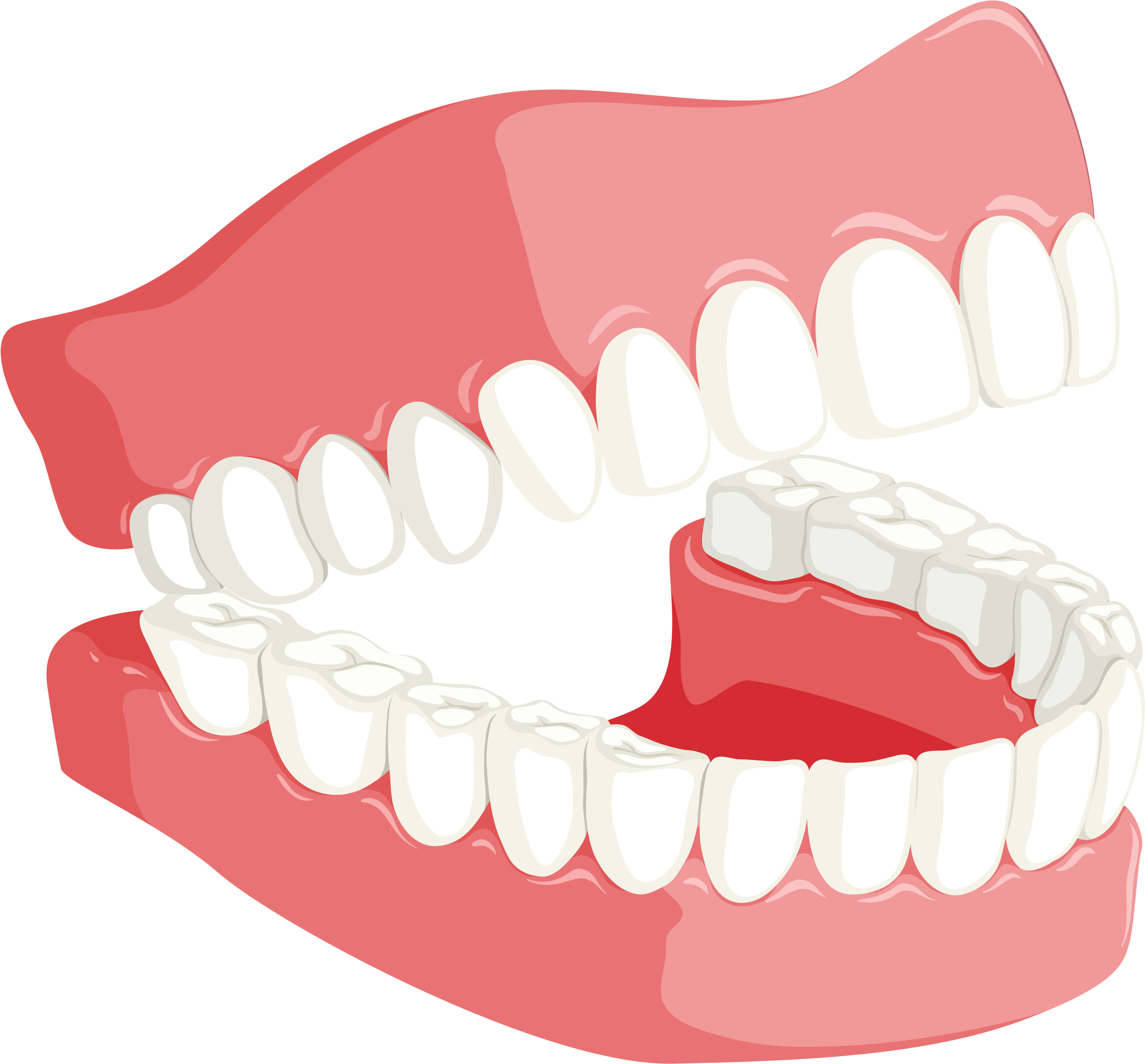 6251 X 4167 2 - Teeth Dental Png.