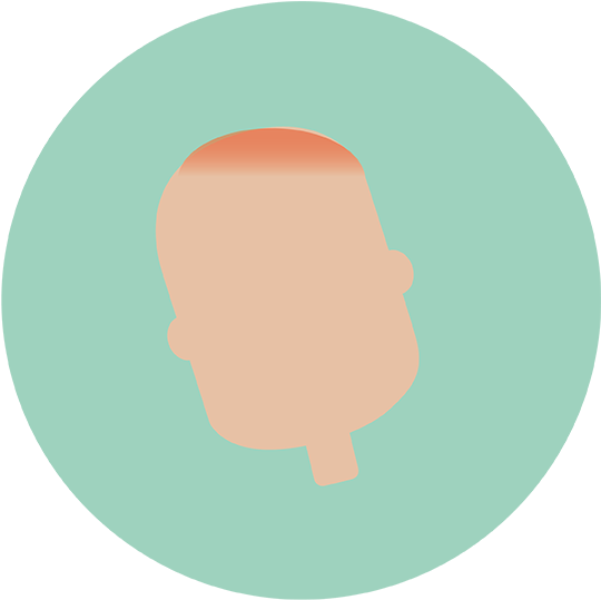 Sunburn - Illustration (800x640)