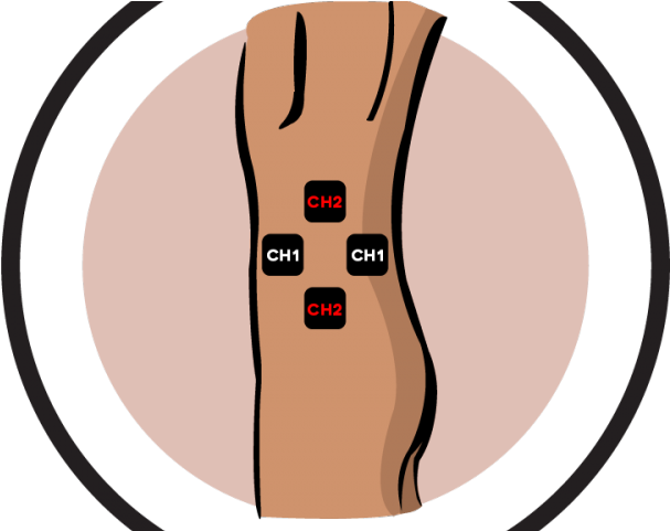 Hip Clipart Chronic Pain - Illustration (640x480)
