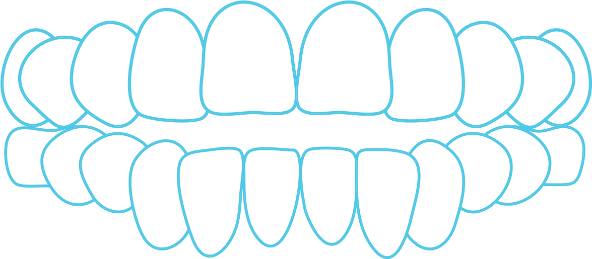 Clear Aligner System Open - Circle (1200x602)
