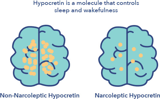 Narcoleptic Hypocretien Vs - Hypocretin Narcolepsy (587x356)