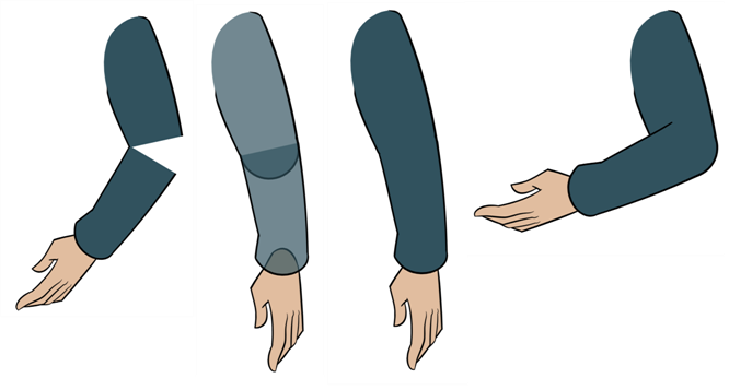 Classical Articulation Is Done By Erasing A Part Of - Classical Articulation Is Done By Erasing A Part Of (666x357)