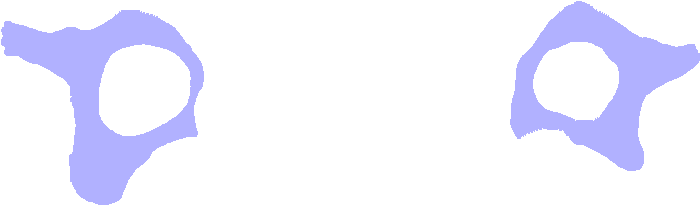 Body Lamina Pedicles Spinous Process Superior Articular - Body Lamina Pedicles Spinous Process Superior Articular (770x650)