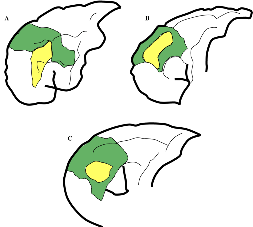 Comparison Of Approximate Locations Of Areas 9 And - Comparison Of Approximate Locations Of Areas 9 And (850x740)
