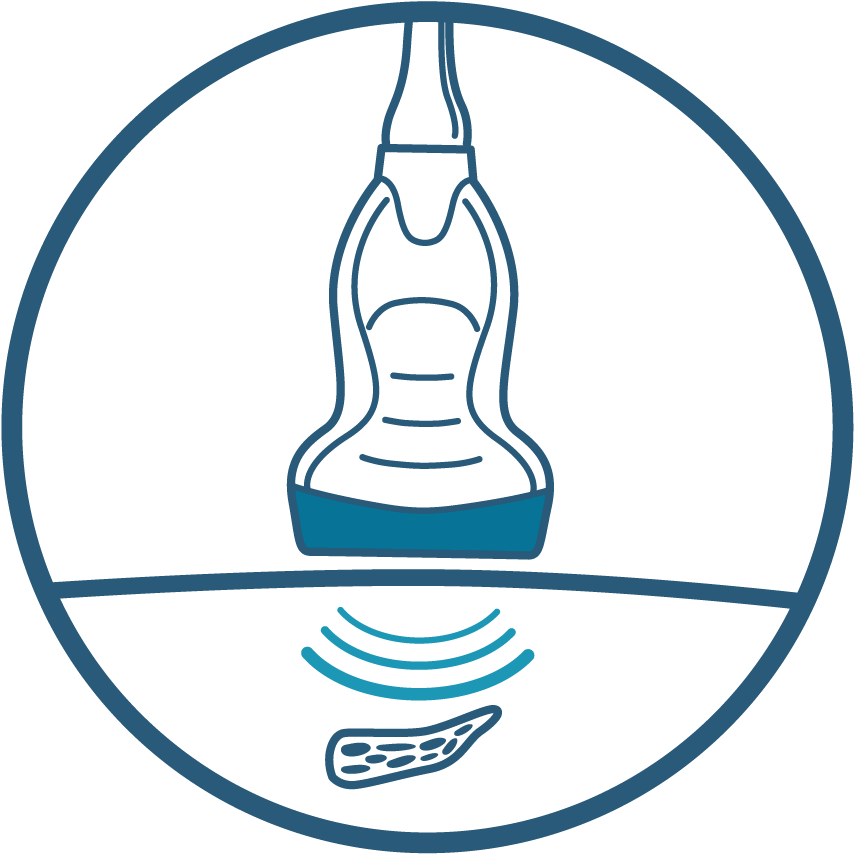 Nervenultraschall Normwerte - Shachihata Inc. (886x886)