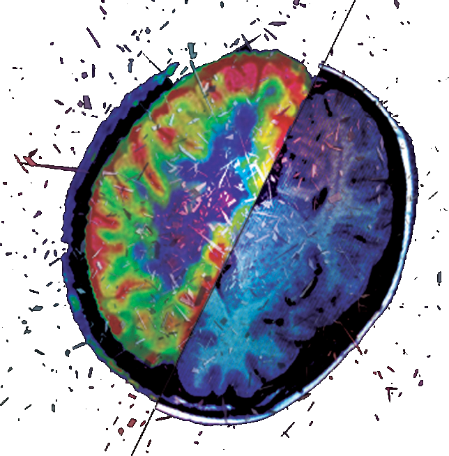 Our Software Supports The Diagnosis By Automatizing - Circle (644x654)