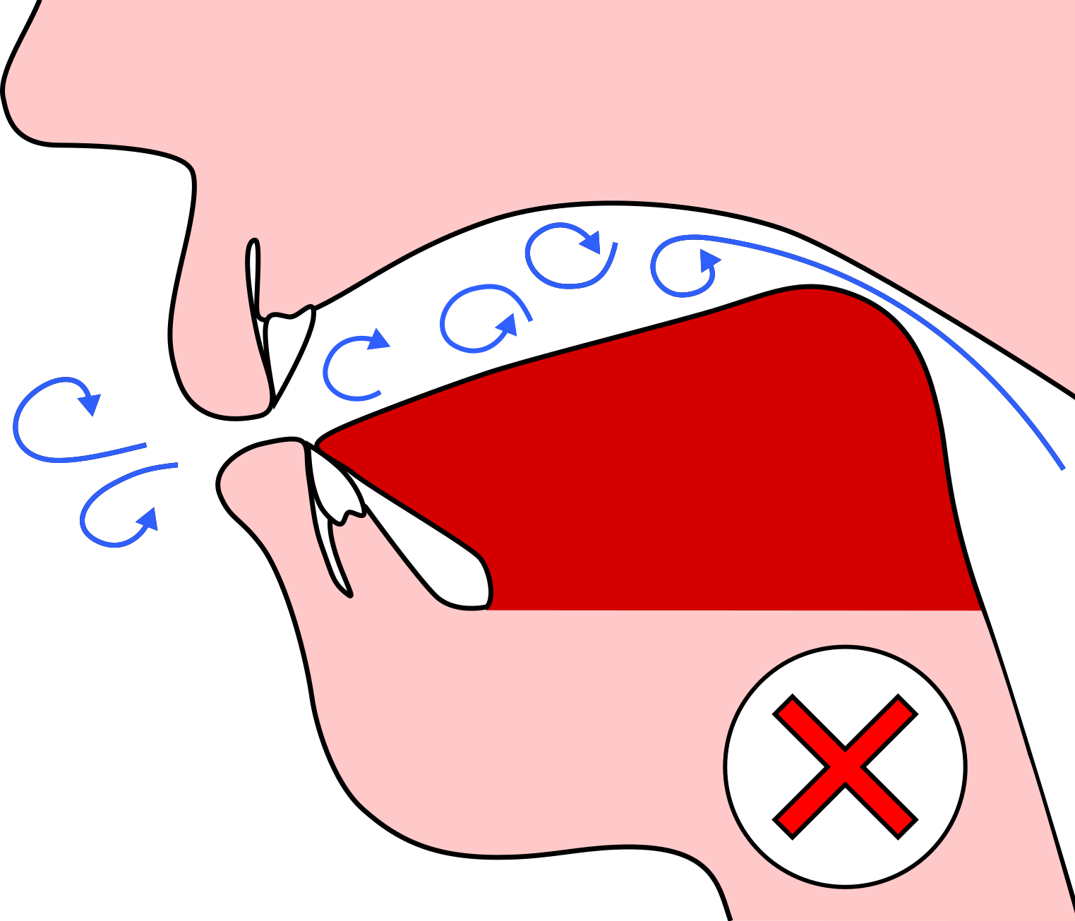 Rear Of Tongue Raised - Rear Of Tongue Raised (1523x1305)