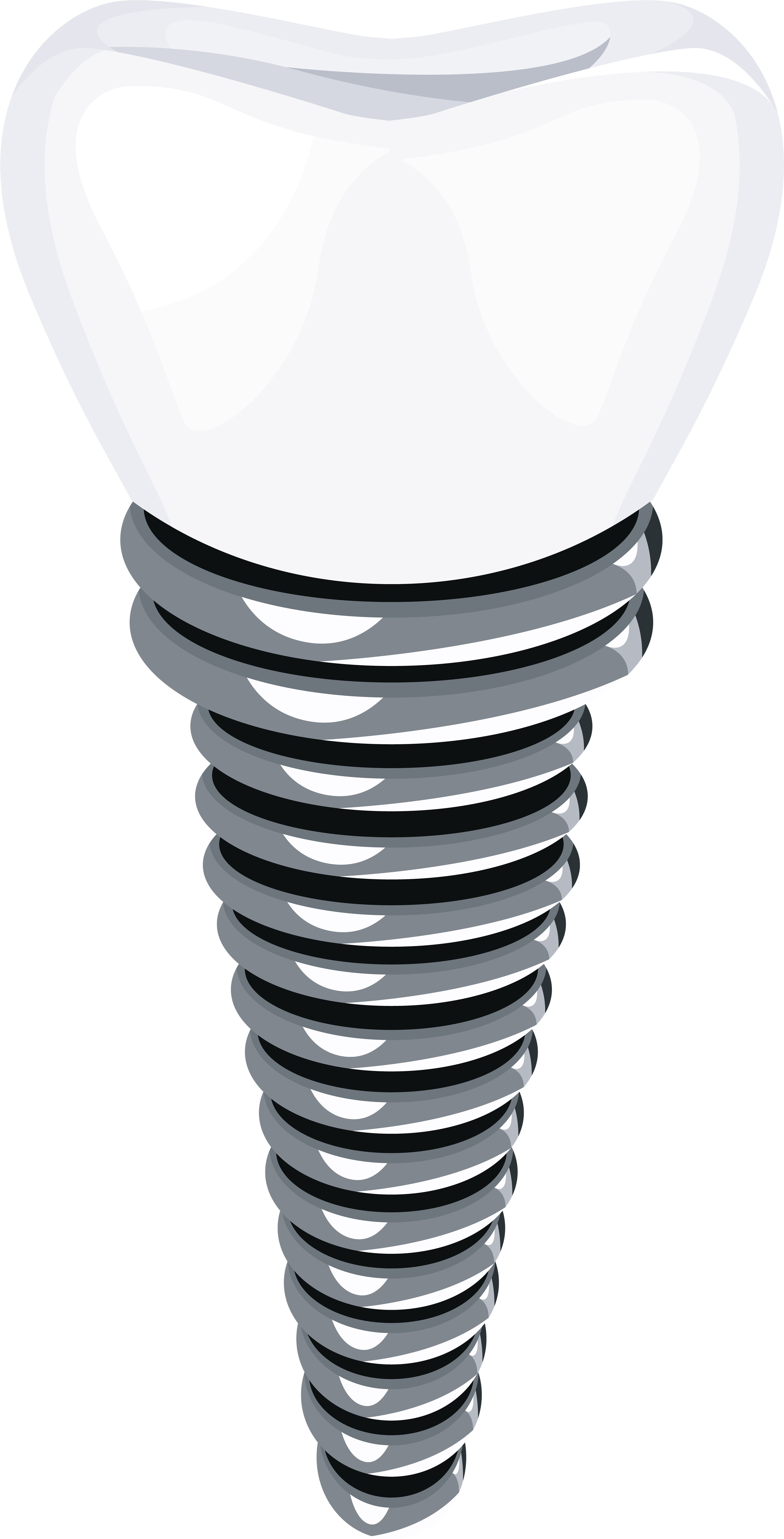 Dental Implant Png Clip Art - Dental Implant Clip Art (4137x8000)