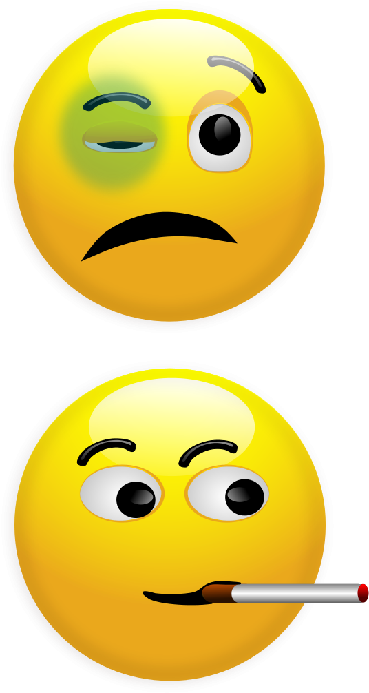 Smiley Emoticon Black Eye Clip Art - Smiley Emoticon Black Eye Clip Art (586x1200)