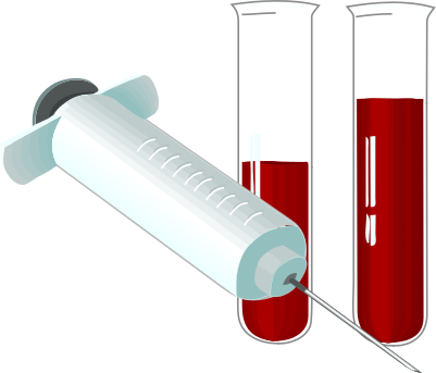 Blood Test Clipart - Blood Test Clip Art (401x343)