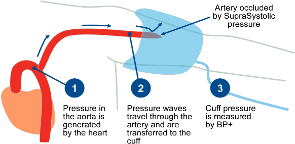Bp Central Blood Pressure Trans - Central Blood Pressure Measurement (600x300)