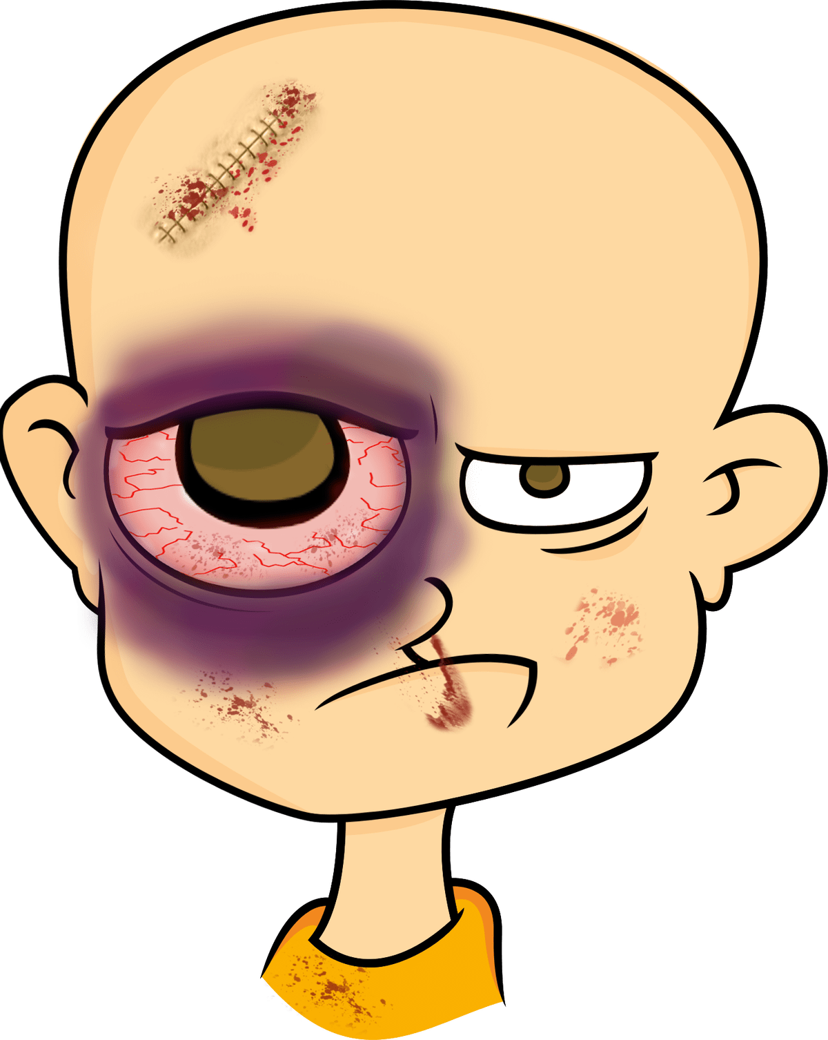 A 21 Year Old Man Was Minding His Own Business On A - Cartoon Man With Black Eye (1200x1506)