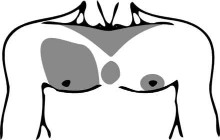 Four Areas In The Setty Chest Hair Pattern System - Chest In Black And White (440x281)