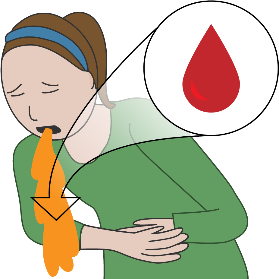 Bruising, Tarry Stools, Vomiting Of Blood Or Blood Peptic Ulcer