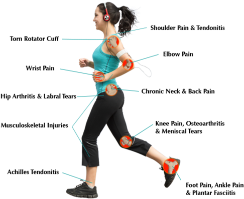 Top Physical Therapists Nyc - Physiotherapy Conditions (500x397)