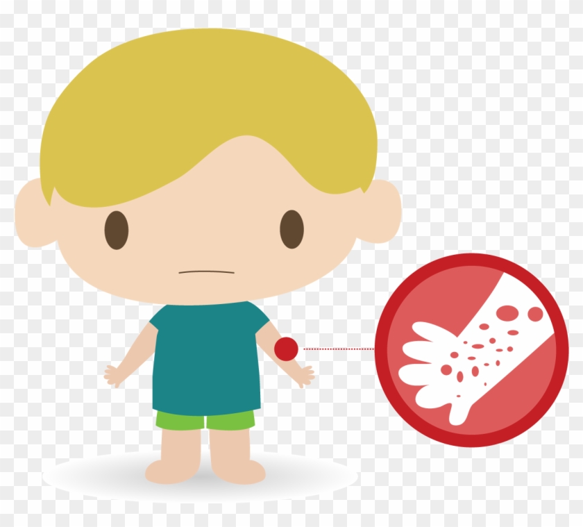 Rashes - Rash Png #463807