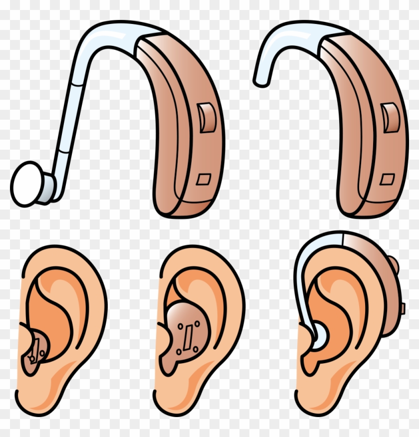 Hearing Aid Hearing Loss - Hearing Aid Hearing Loss #487439