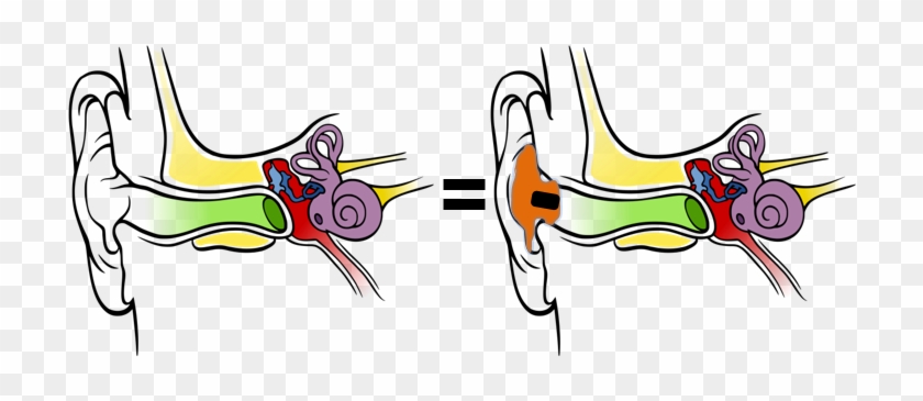 The Subjective Listening Impressionis Supposed To Be - Anatomy Of The Human Ear #487477