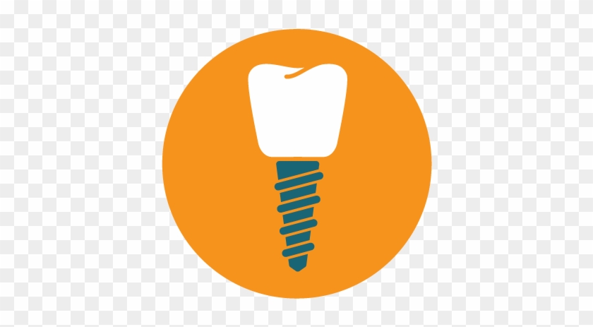 Dental Implants - Dentistry #494405