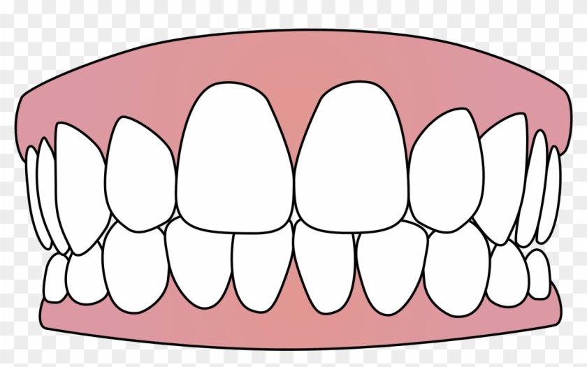 Human Tooth Computer Icons Clip Art - Teeth Icon #498135