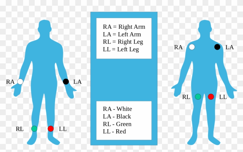 Two Common Electrodes Used Are A Flat Paper Thin Sticker - 4 Lead Ecg Electrode Placement #500672