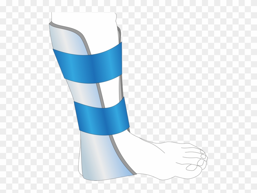 The Prometheus Omni Splint Is Also Now Available To - Splint Clip Art #523172