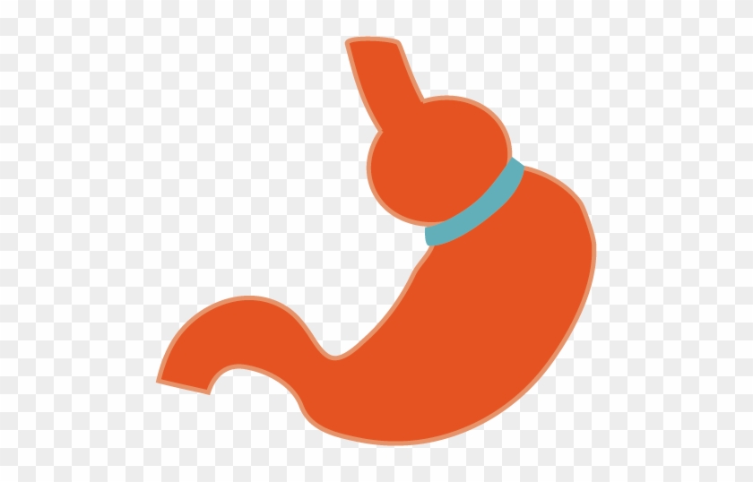 Laparoscopic Adjustable Gastric Band Is A Type Of Weight - Adjustable Gastric Band #524714