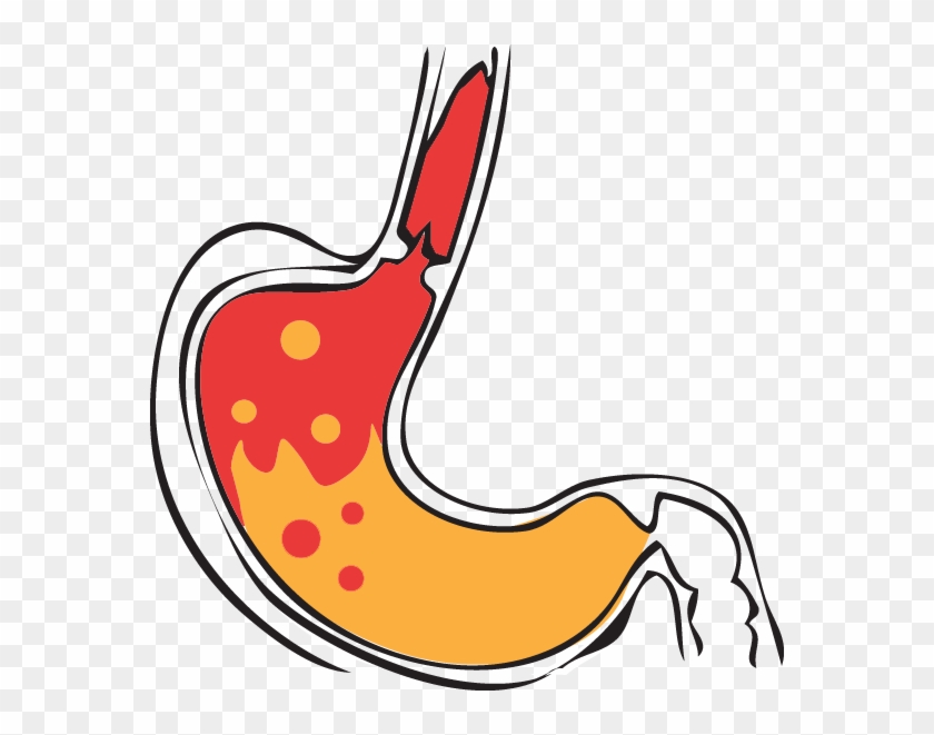 Gastric Acid Stomach Pepsin Hydrochloric Acid Clip - Stomach Acid Png #537037