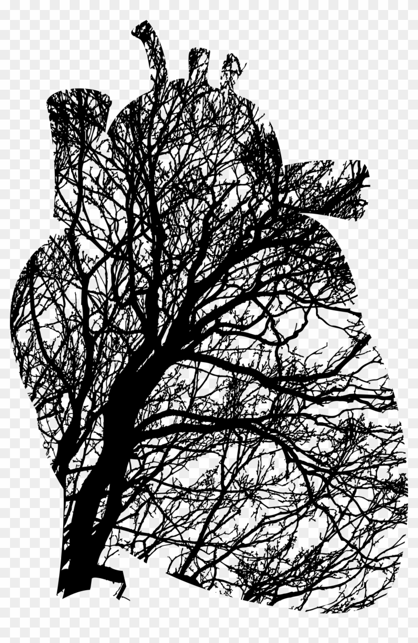 Tree Branch Biology Clip Art - Tree Branch Biology Clip Art #540065